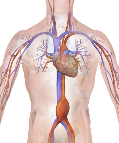 Abdominal Aneurysm.