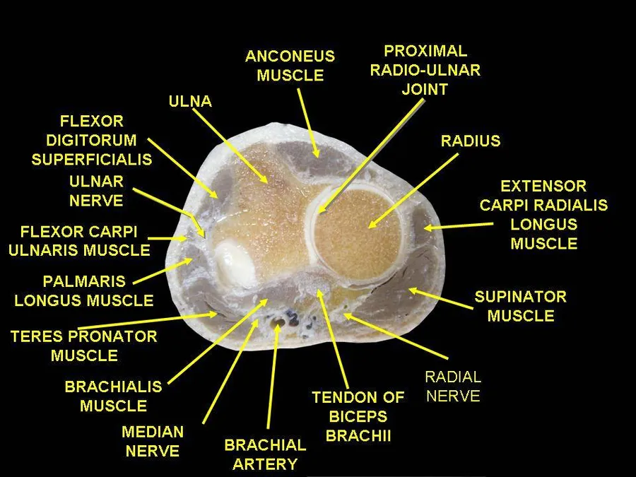 Anatomical dissections
