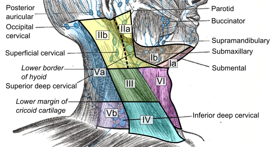 Superficial cervical lymph nodes and lymph node levels, initially described by the Memorial Sloan-Kettering Cancer Center (New York, NY) and further specified by the Committee for Head and Neck Surgery and Oncology of th