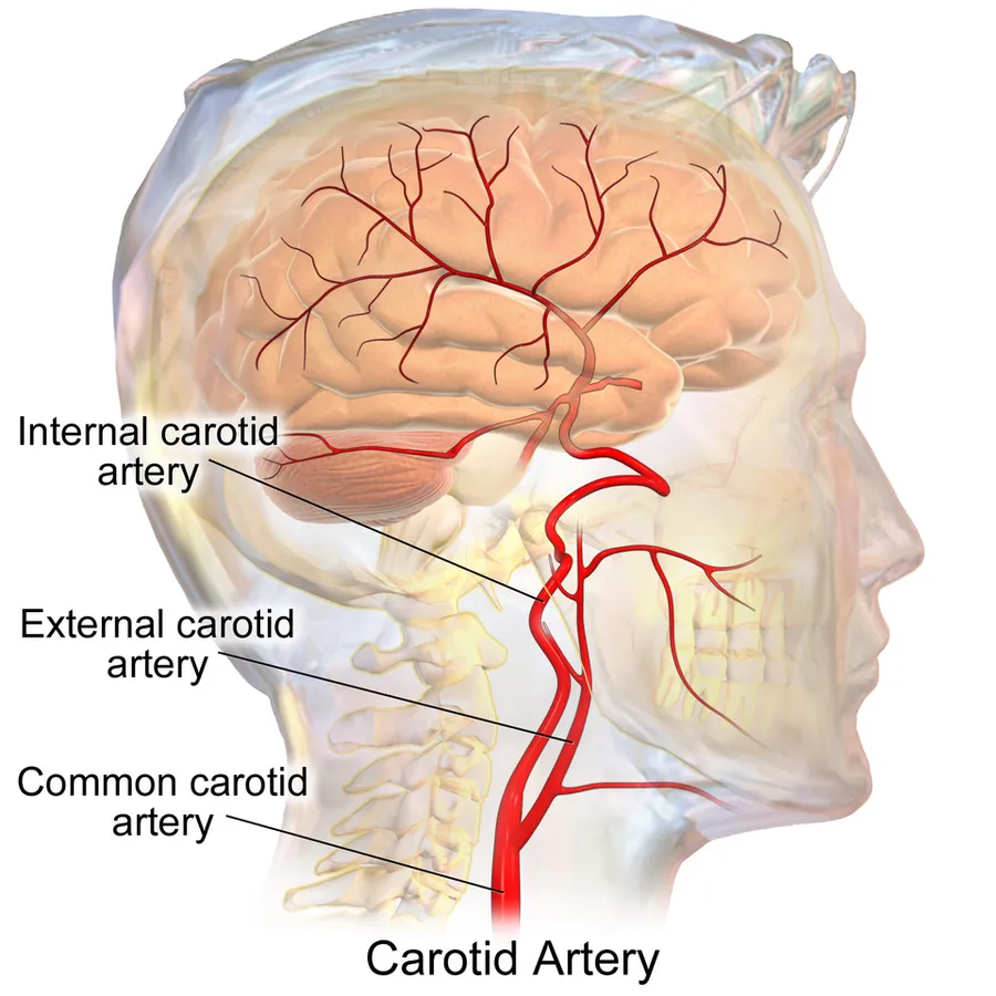 Carotid Arteries.