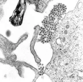 A TEM micrograph showing Dengue virus virions (the cluster of dark dots near the center).
