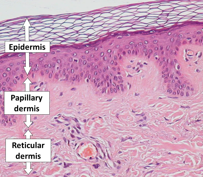 Epidermis, papillary dermis and reticular dermis. H&E stain.