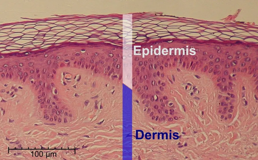 This is a hematoxylin and eosin stained slide at 10x of normal epidermis.