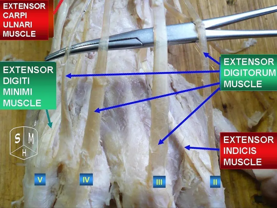 Extensor digitorum muscle