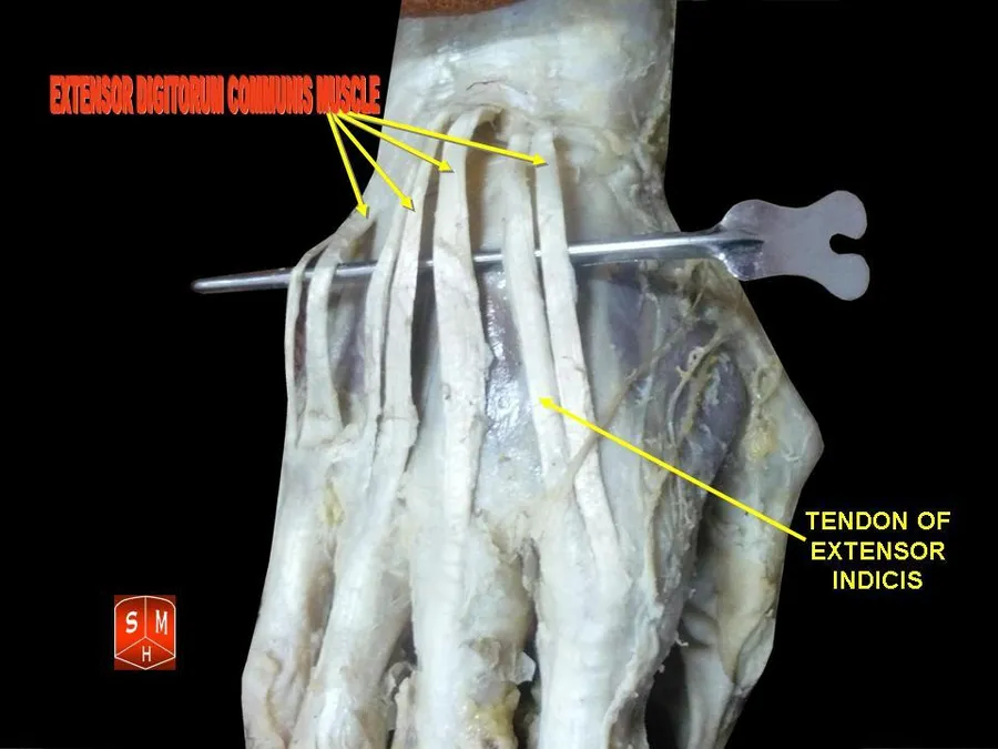 Anatomical preparations