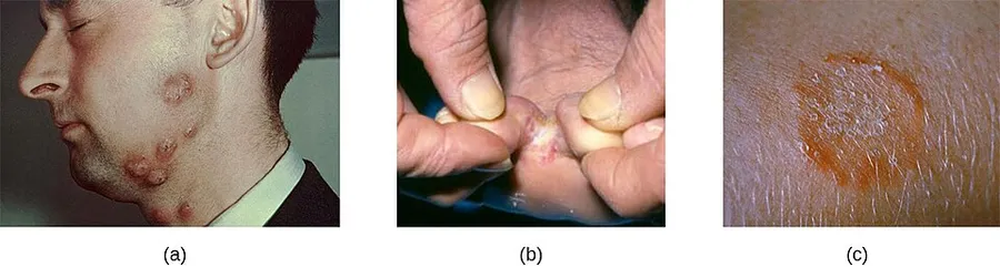 Name: Microbiology ID: e42bd376-624b-4c0f-972f-e0c57998e765@4.4 Language: English Summary: Subjects: Science and Technology Keywords: Print Style: License: Creative Commons Attribution License (by 4.0) Authors: OpenStax