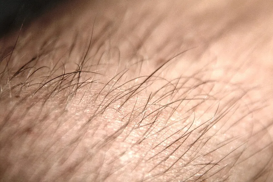 Arm hair on a male human.