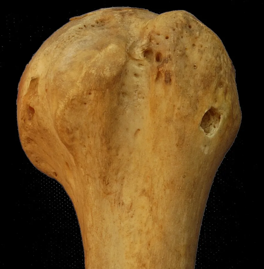 Photograph of anterior aspect of left human humerus (slightly lateral to anterior, in retrospect). Note that the hole in lateral aspect of humerus (on the right in the image) is artificial (used for articulating the skel