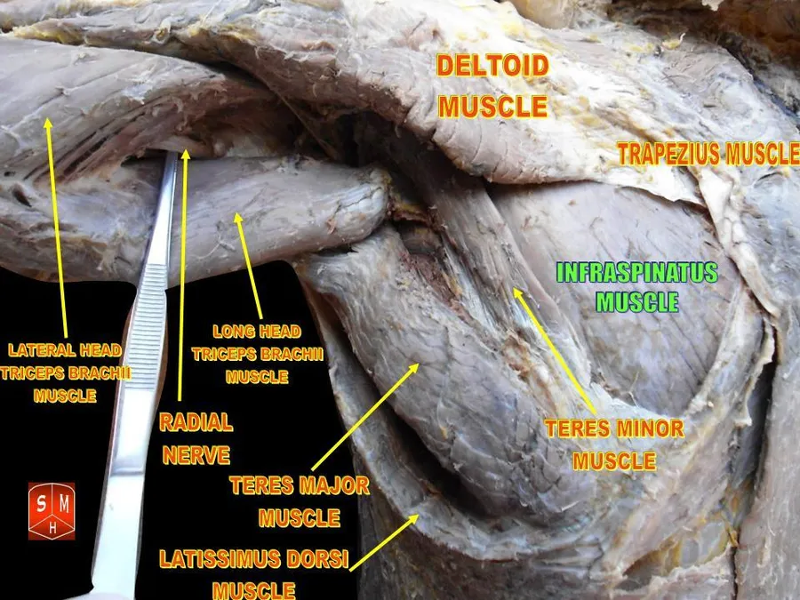 Anatomical dissections