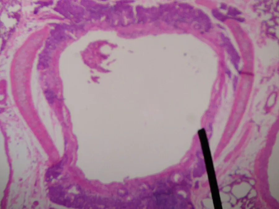 Author's own picture. A digital camera shot through a microscope; with a human cross sectional cut of a secondary bronchus