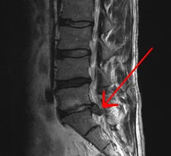 Photo taken in the MRI lab mri of my back.