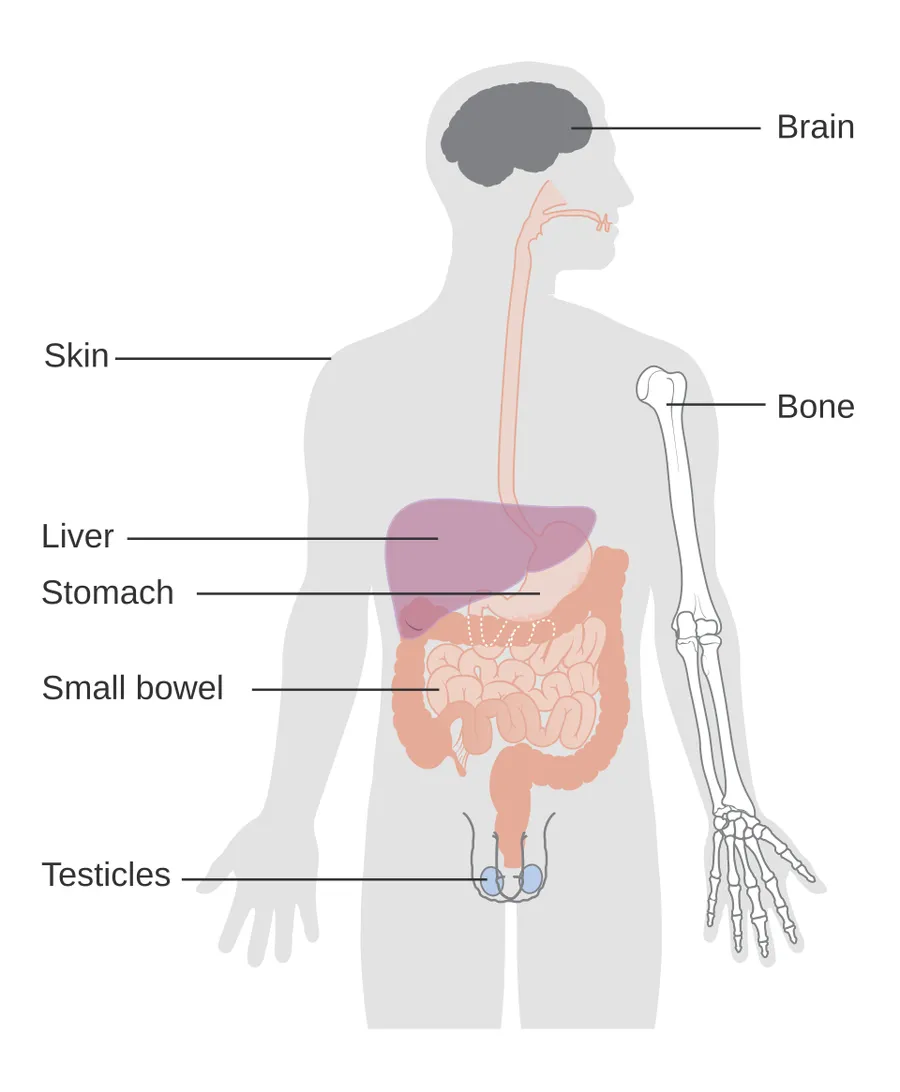 DIagram showing where lymphoma can spread in the body.