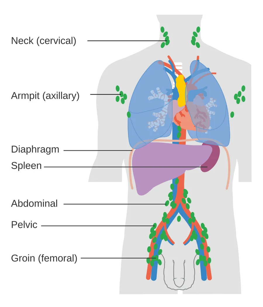 Diagram showing the lymph nodes lymphoma most commonly develops in.