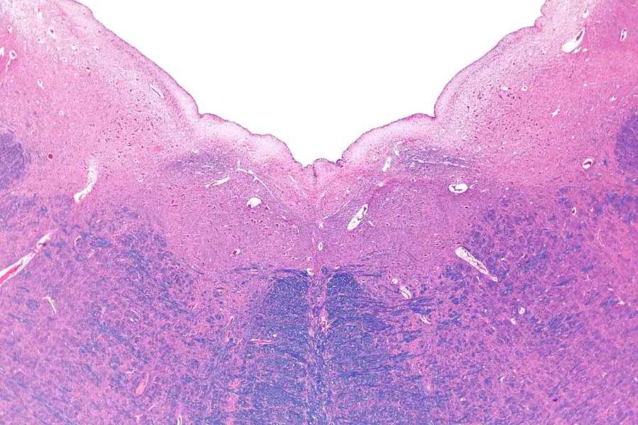 Very low magnification micrograph of the medulla oblongata showing the fourth ventricle and the nuclei of the hypoglossal nerve and vagus nerve. H&E-LFB stain. Related images Very low mag. Low mag. Intermed. mag. CN