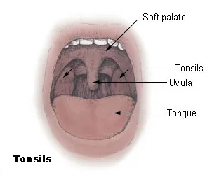 Diagram of the palatine tonsils from U.S. National Cancer Institute web site http://training.seer.cancer.gov/module_anatomy/unit8_2_lymph_compo2_tonsils.html, Uploaded on 18 December 2004 from U.S. National Cancer Instit