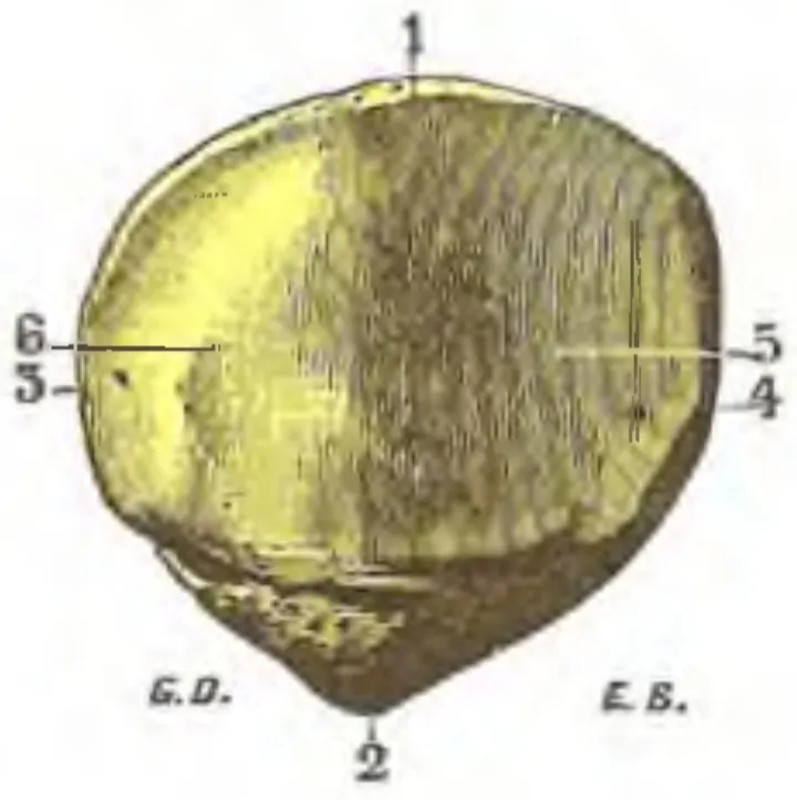 Anatomical cartoon depicting the posterior aspect of a right-sided human patella.