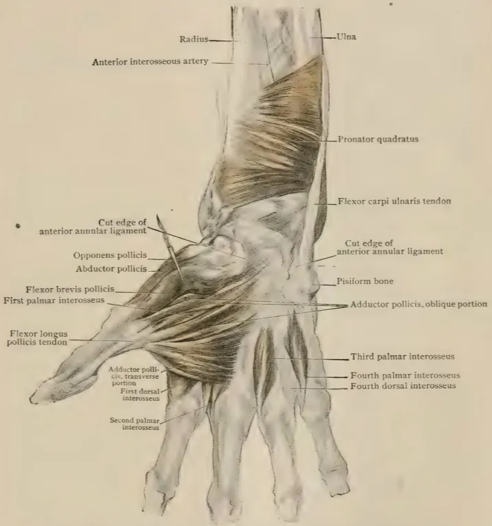 Dissection of right wrist and hand, showing pronator quadratus and short muscles of thumb.