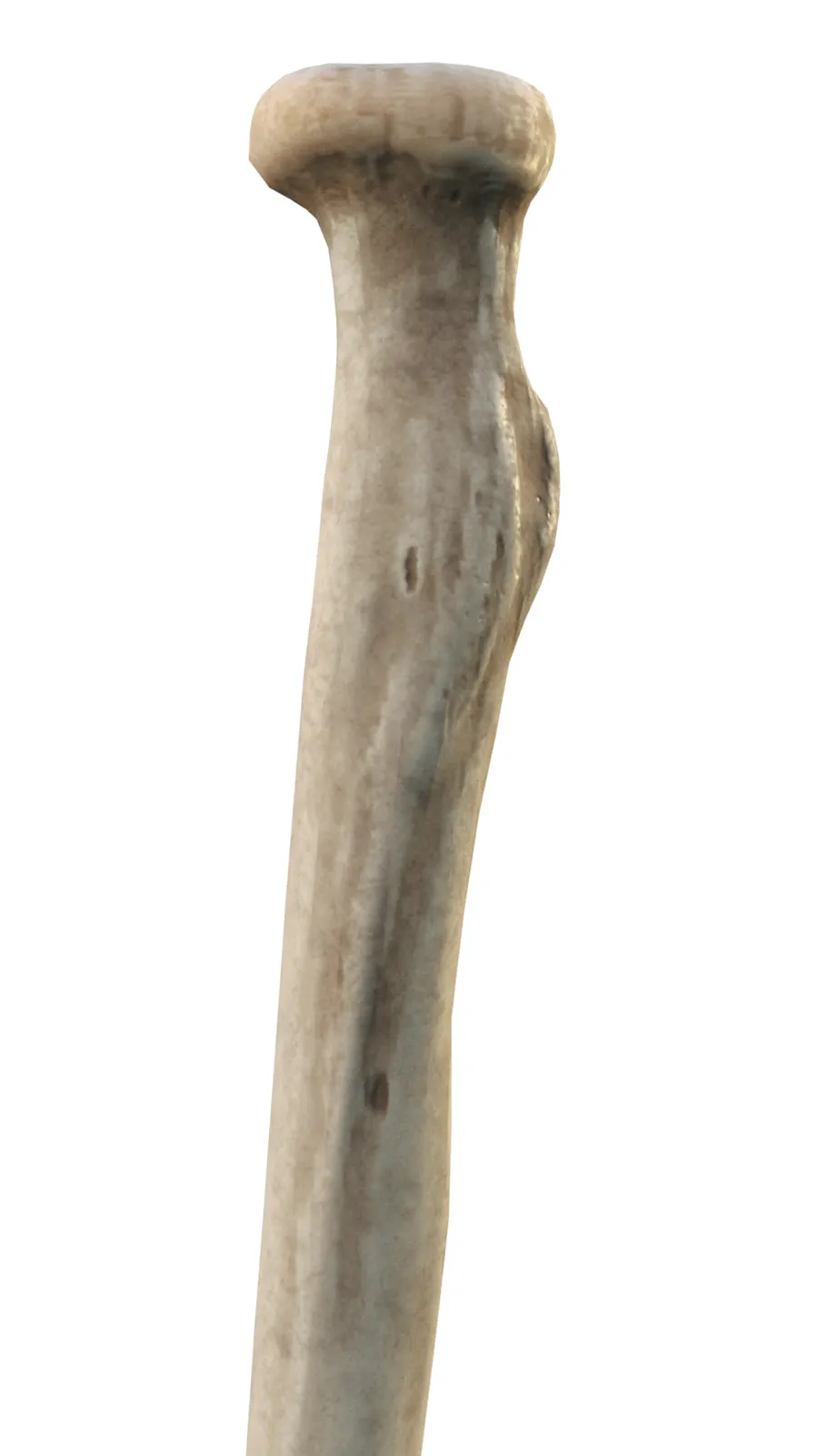 Computer Generated 3d Model showing: Anterior View of Right Proximal Radius. You can see the Radial head, Radial neck, Radial Tuberosity, Anterior Oblique Line, Nutrient foramen, anterior border, lateral surface, and the