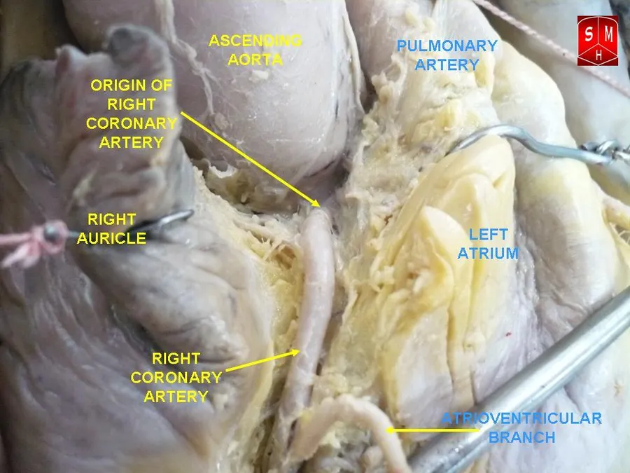 Coronary arteries