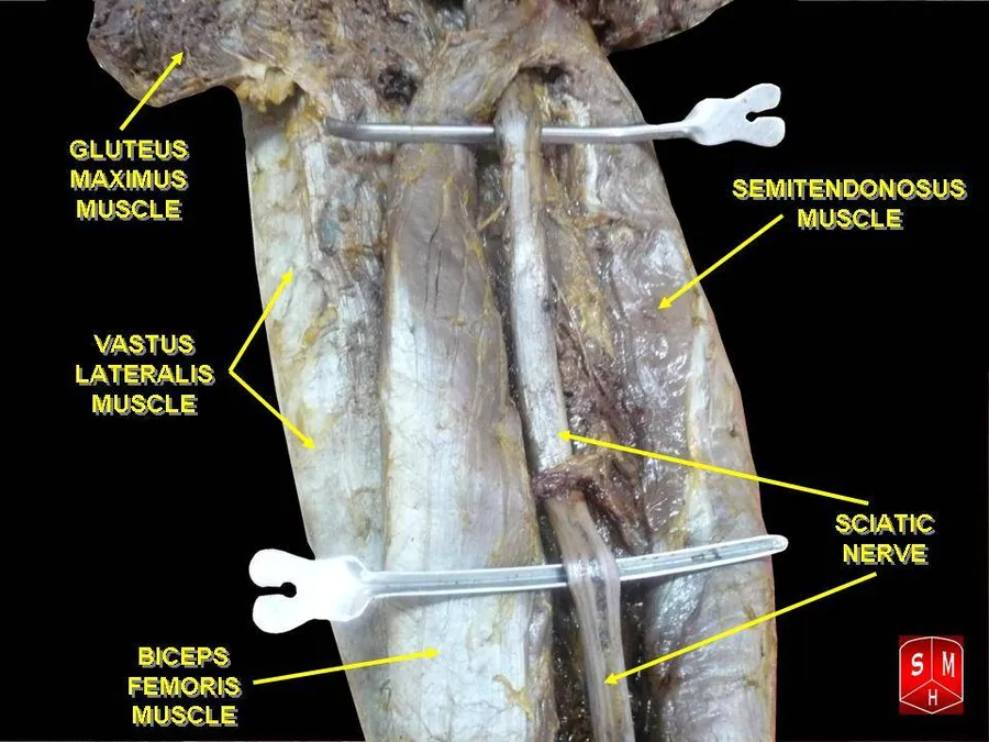 Sciatic nerve
