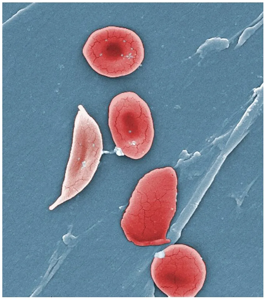 Illustration from Anatomy & Physiology, Connexions Web site. https://cnx.org/content/col11496/1.6/, Jun 19, 2013.