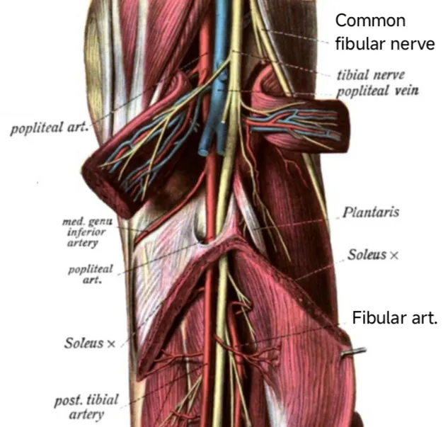 Anatomical illustration depicting the soleus muscle, its tendinous arch and surrounding anatomy.