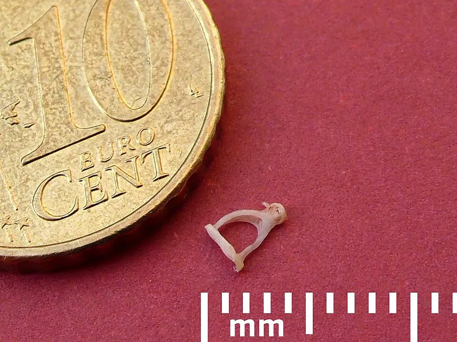 Stapes, human ear