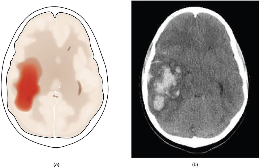 Illustration from Anatomy & Physiology, Connexions Web site. http://cnx.org/content/col11496/1.6/, Jun 19, 2013.