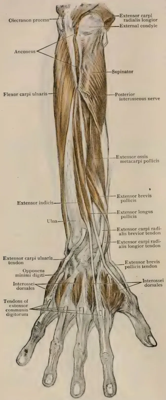 Dissection of posterior aspect of right-sided forearm & hand, showing deep muscles.