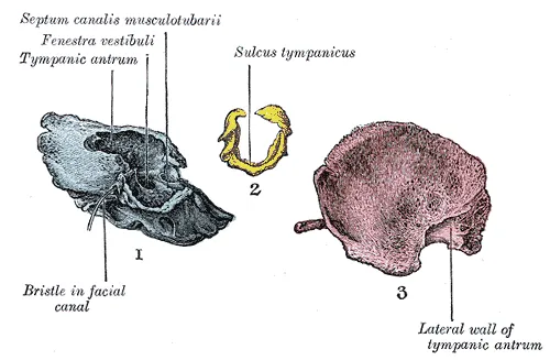The three principal parts of the tempora bone at birth. 1. Outer surface of petromastoid part. 2. Outer surface of tympanic ring. 3. Inner surface of squama.