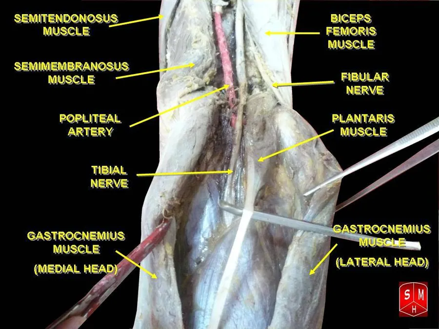 Tibial nerve