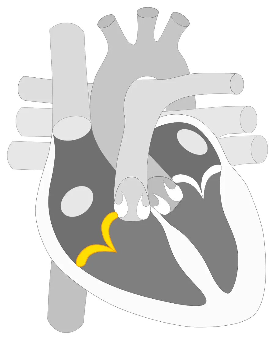 Location of the tricuspid valve in the heart.