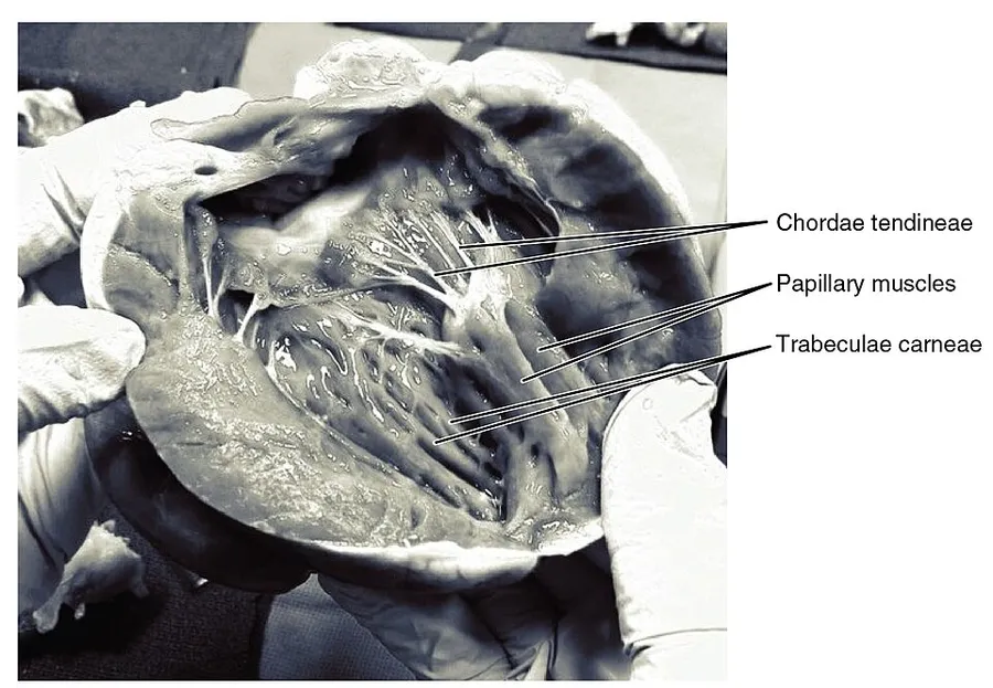"In this frontal section, you can see papillary muscles attached to the tricuspid valve on the right as well as the mitral valve on the left via chordae tendineae. (credit: modification of work by “PV KS”/flickr.com)"Ill