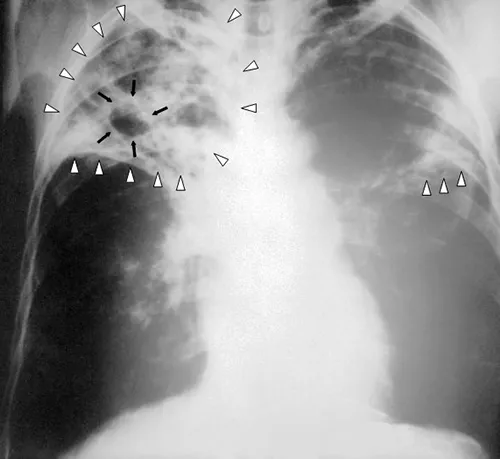 Name: Microbiology ID: e42bd376-624b-4c0f-972f-e0c57998e765@4.4 Language: English Summary: Subjects: Science and Technology Keywords: Print Style: License: Creative Commons Attribution License (by 4.0) Authors: OpenStax