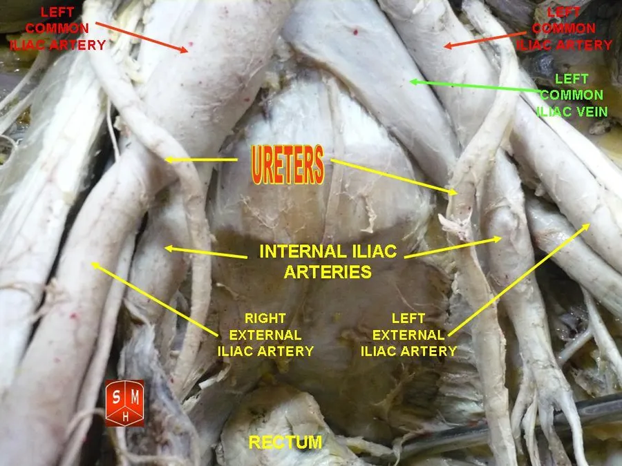 Anatomical preparations