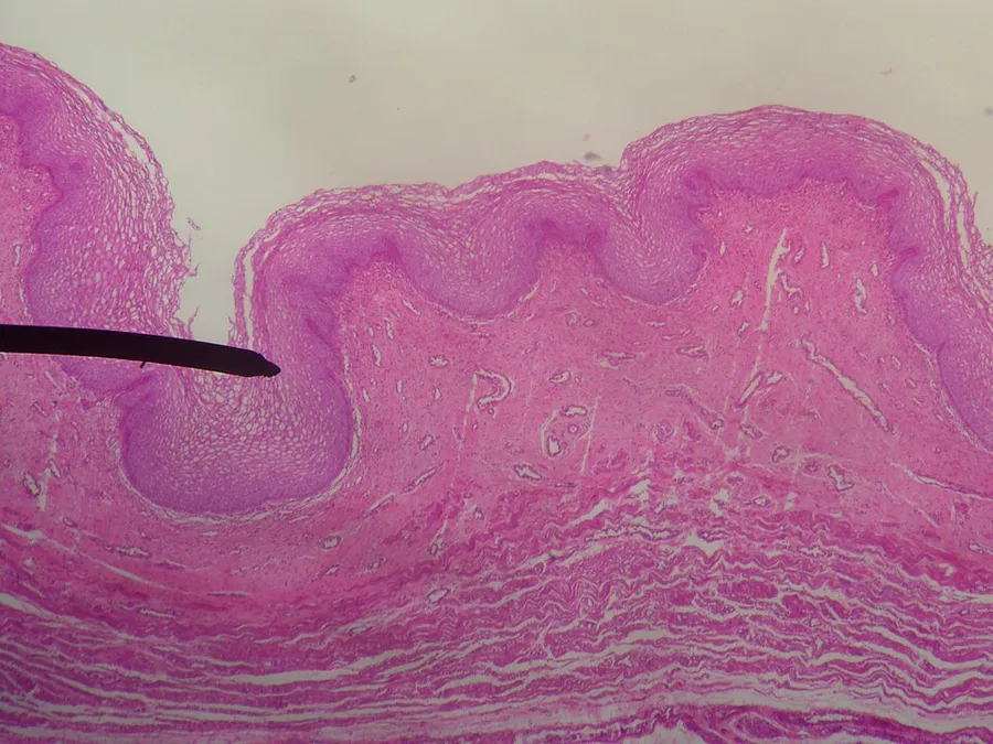 Author's own picture. Digital camera shot though a microscope; human vaginal wall.