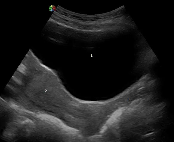 ultrasound. 1: urinary bladder; 2: uterus; 3: vagina